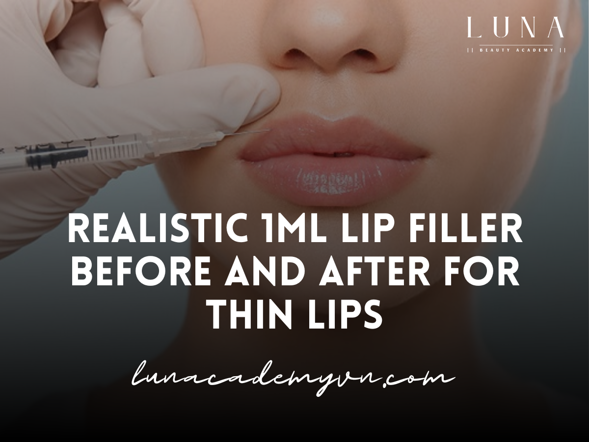 Realistic 1ml Lip Filler Before and After for Thin Lips