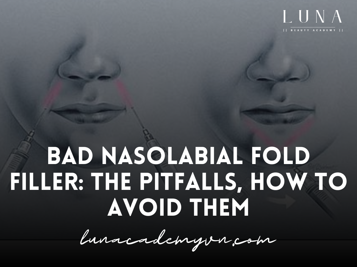 Bad Nasolabial Fold Filler: The Pitfalls, How to Avoid Them