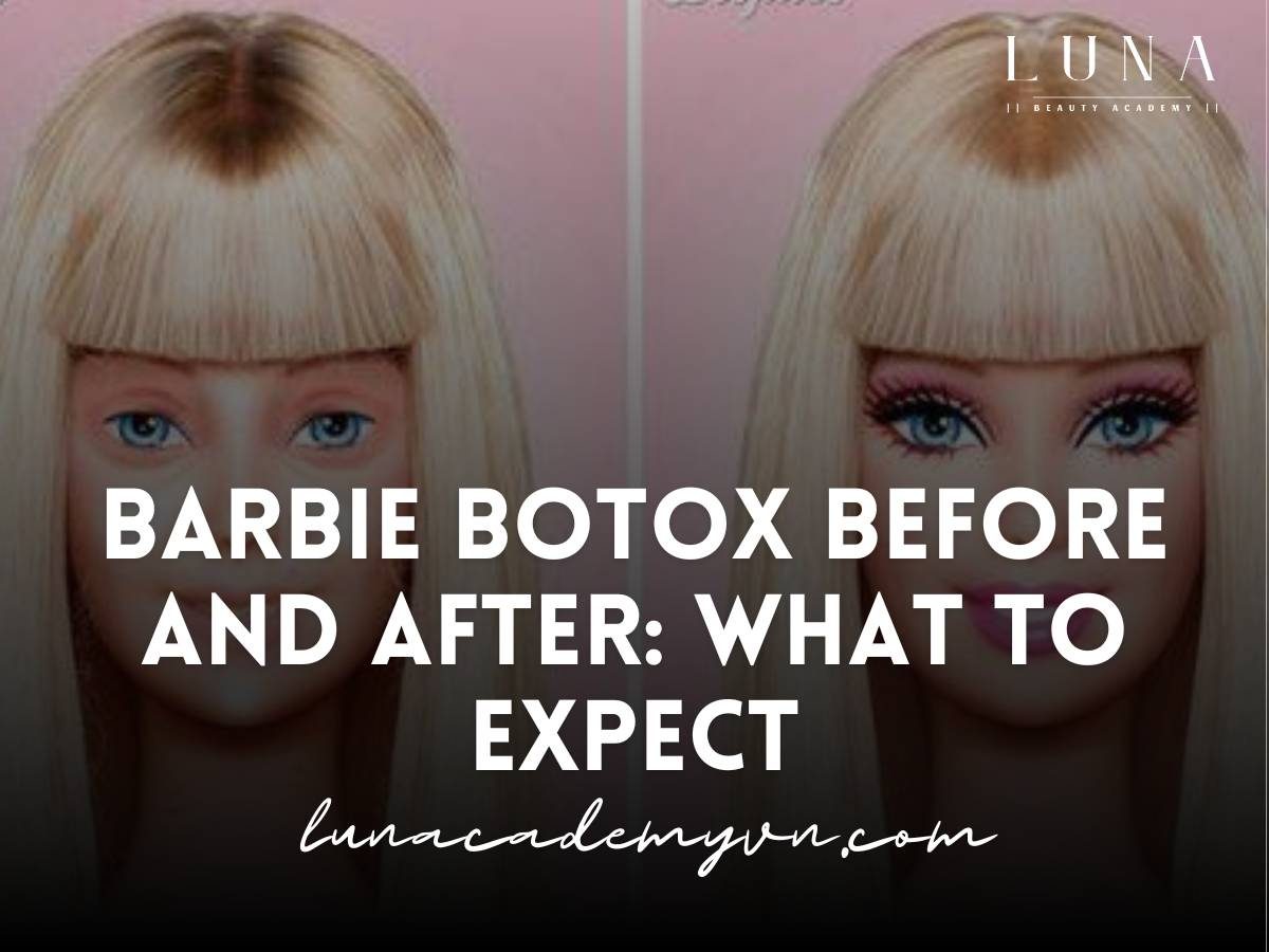 barbie botox before and after