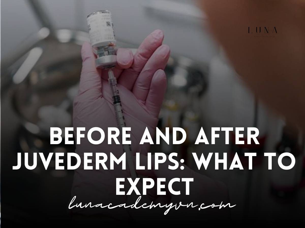 before and after juvederm lips