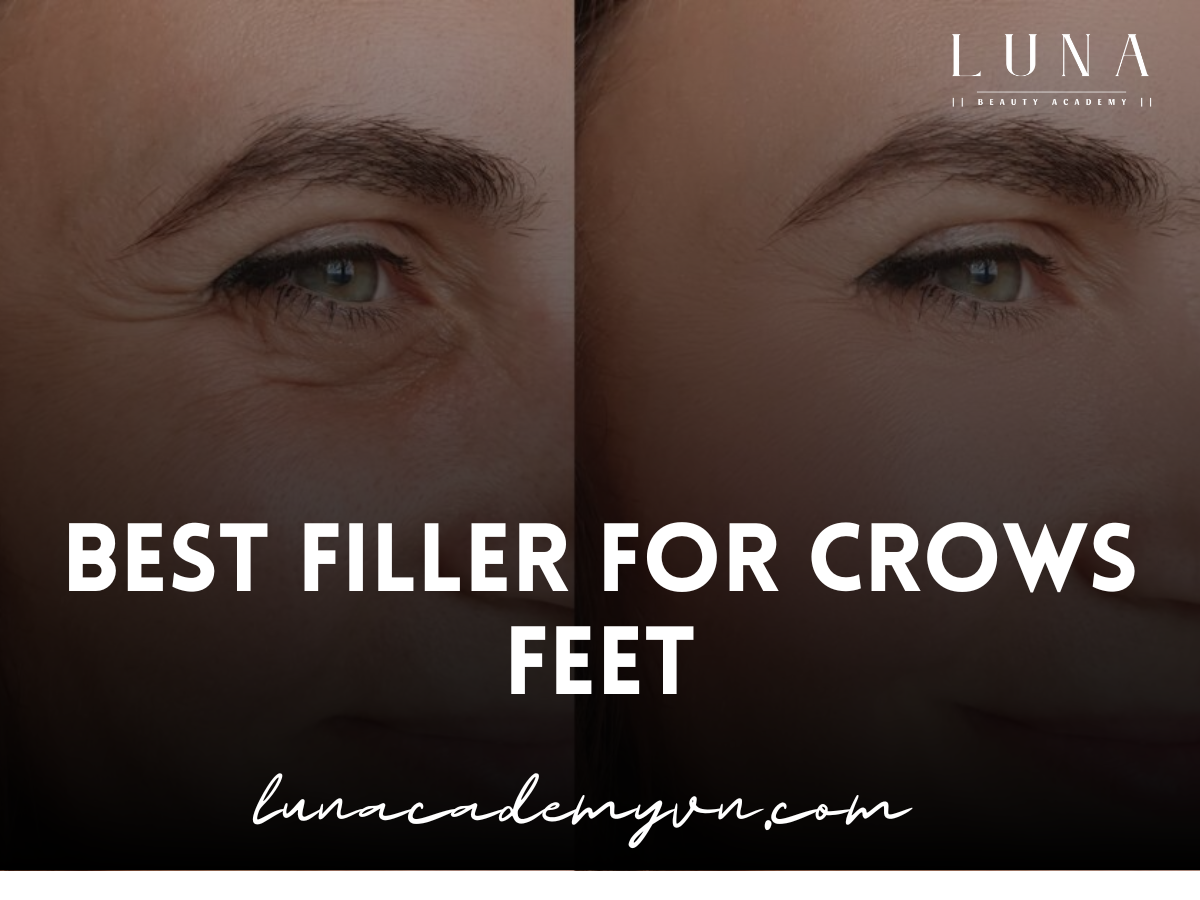 Best filler for crows feet