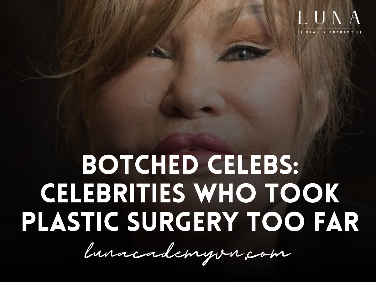 Botched Celebs: Celebrities Who Took Plastic Surgery Too Far