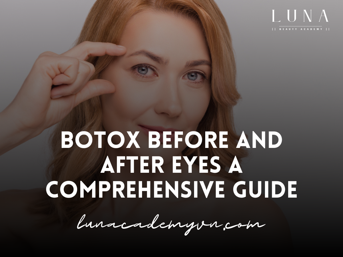 botox-before-and-after-eyes-a-comprehensive-guide