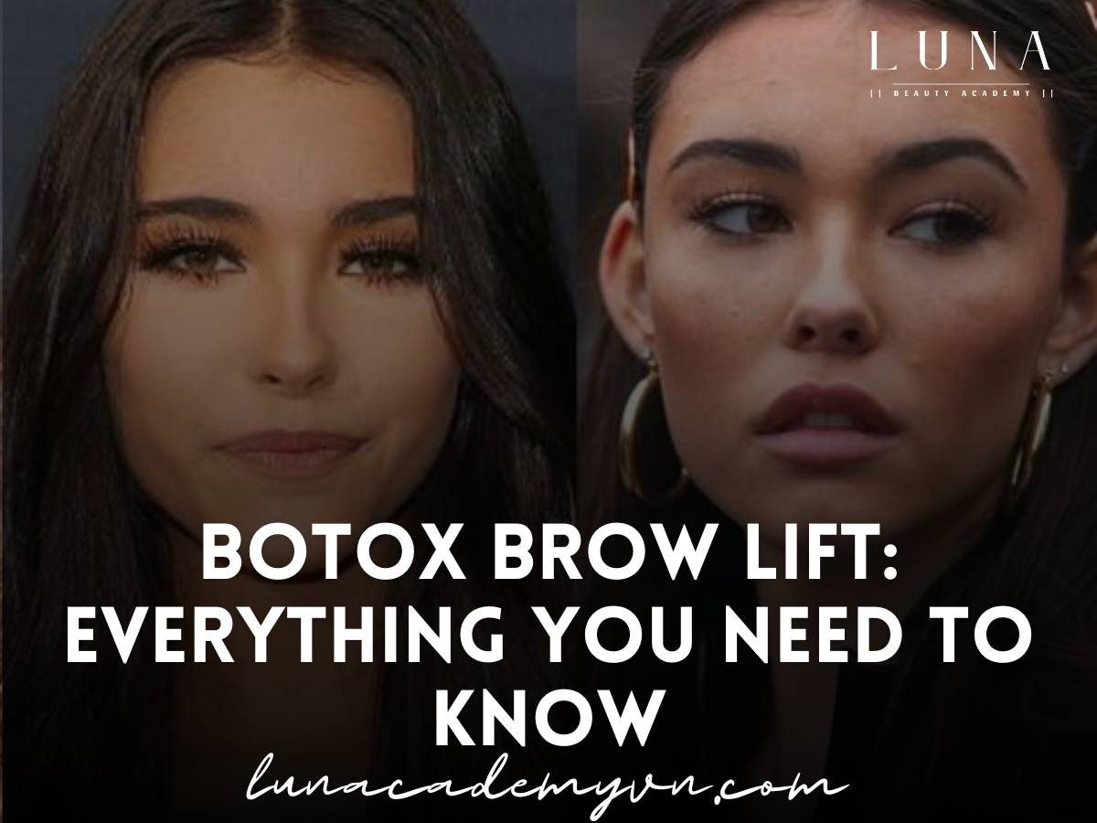 botox brow lift