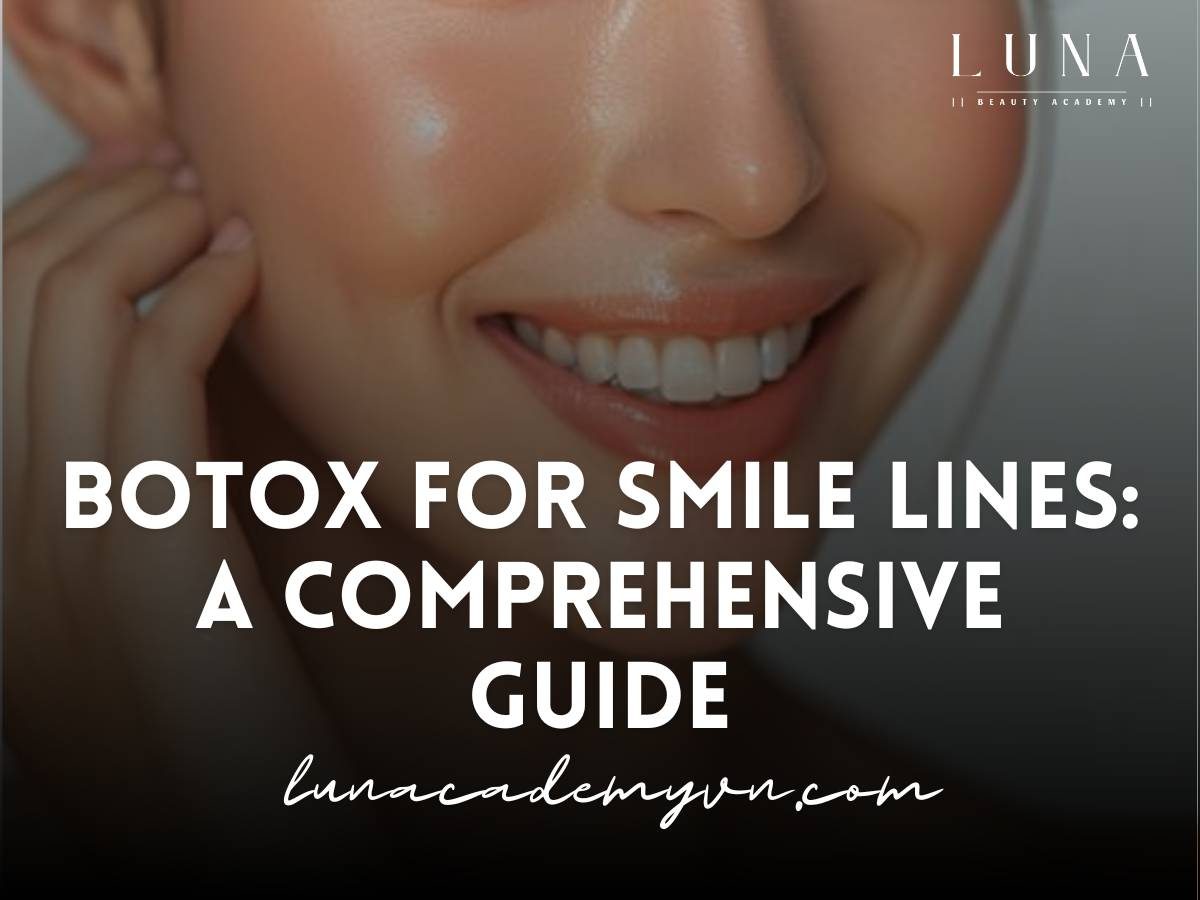 botox for smile lines