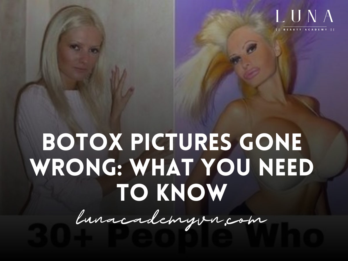 Botox Pictures Gone Wrong: What You Need to Know