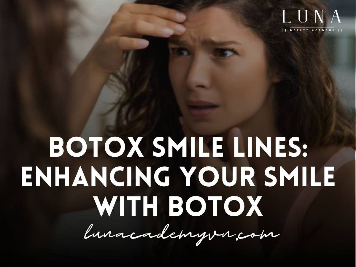 botox smile lines