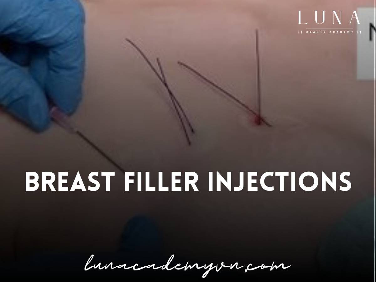 breast filler injections