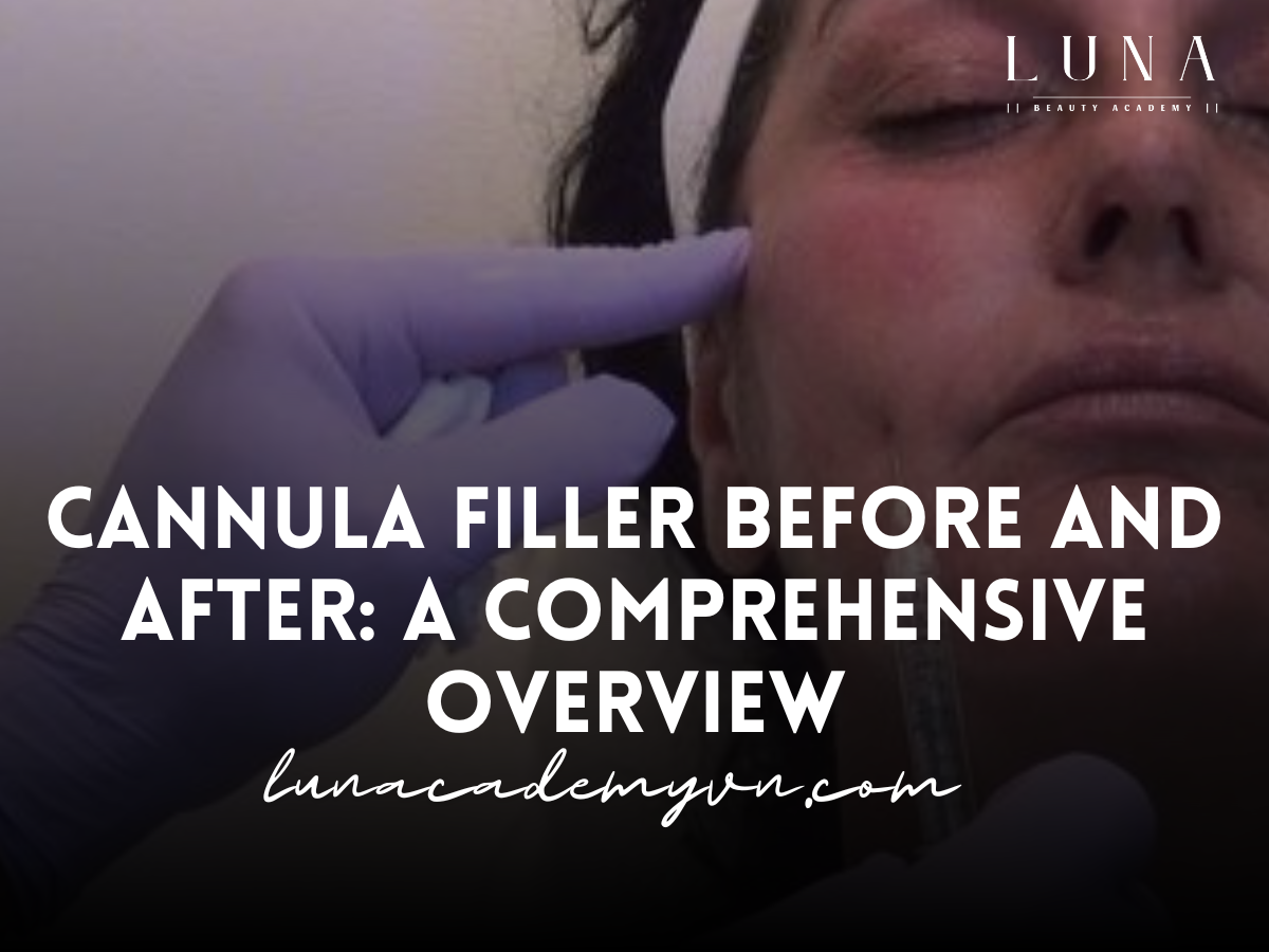 Cannula Filler Before and After: A Comprehensive Overview