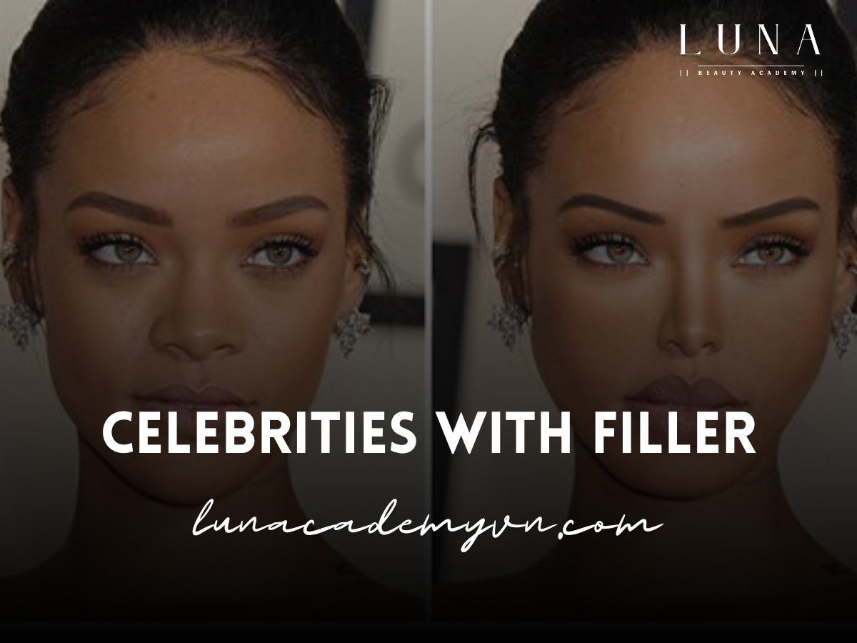 Celebrities with Filler: A Look at Stars Embracing Cosmetic Enhancements