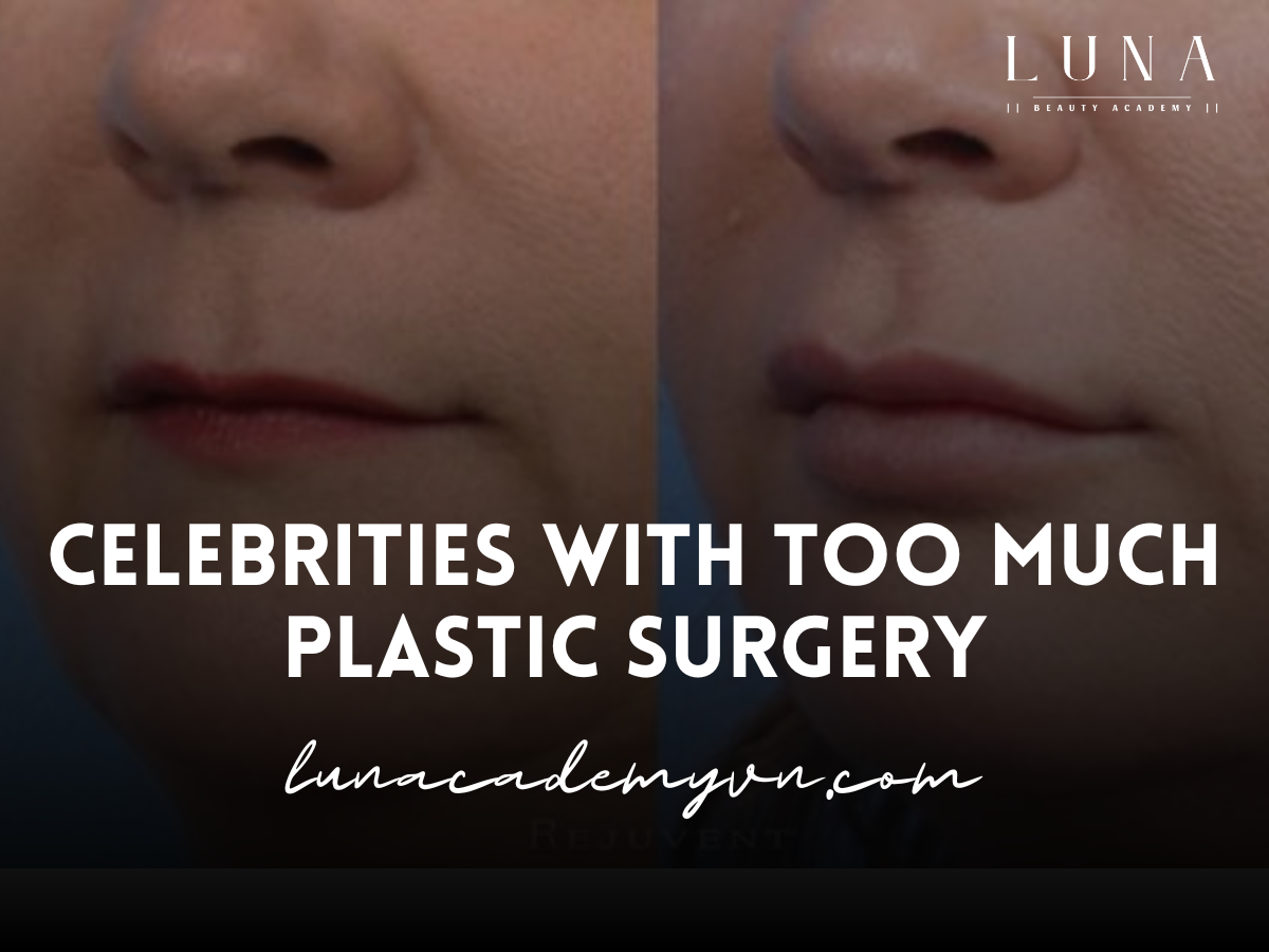 Celebrities with Too Much Plastic Surgery