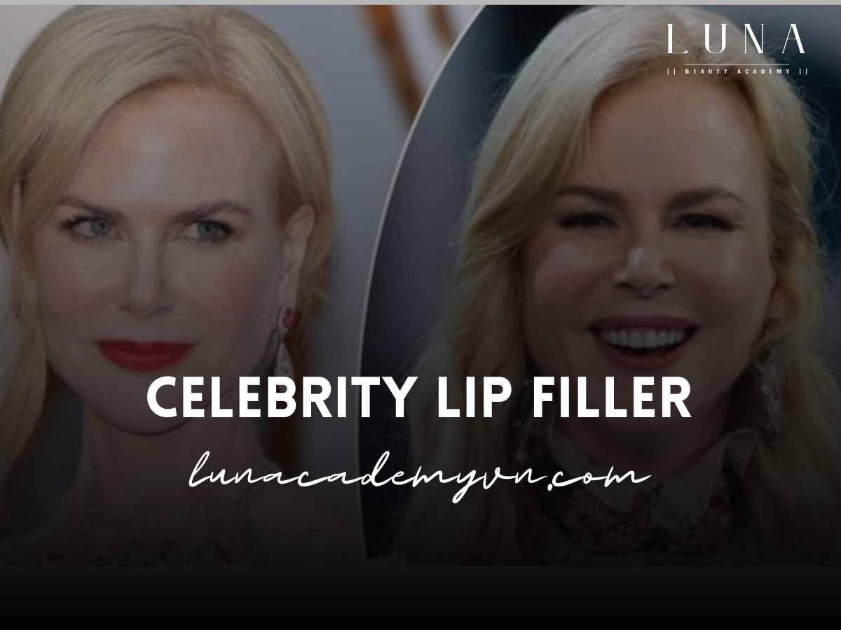 celebrity lip filler