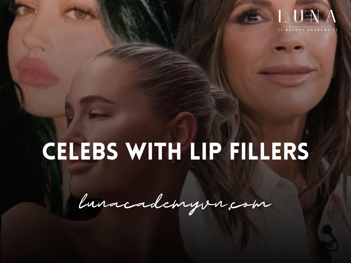 Celebs with Lip Fillers