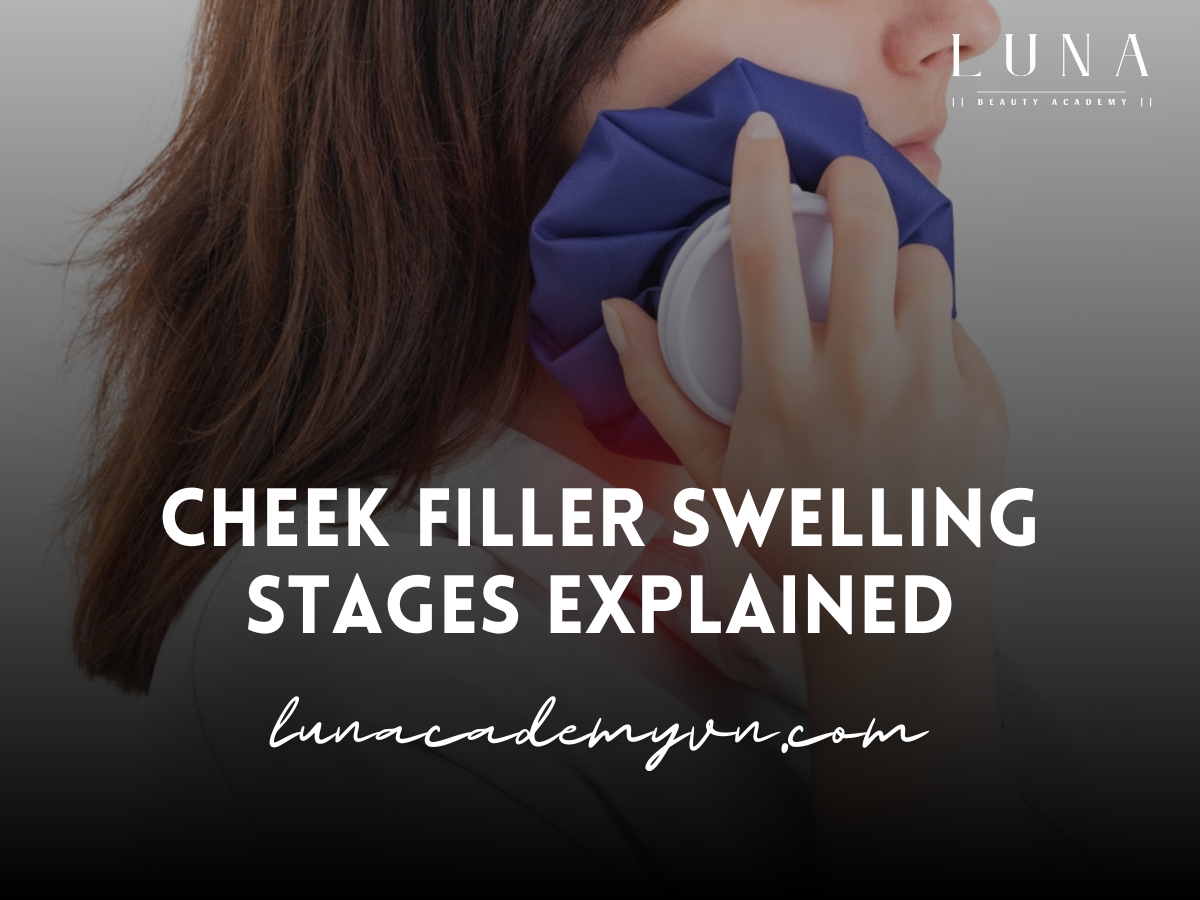 Cheek Filler Swelling Stages