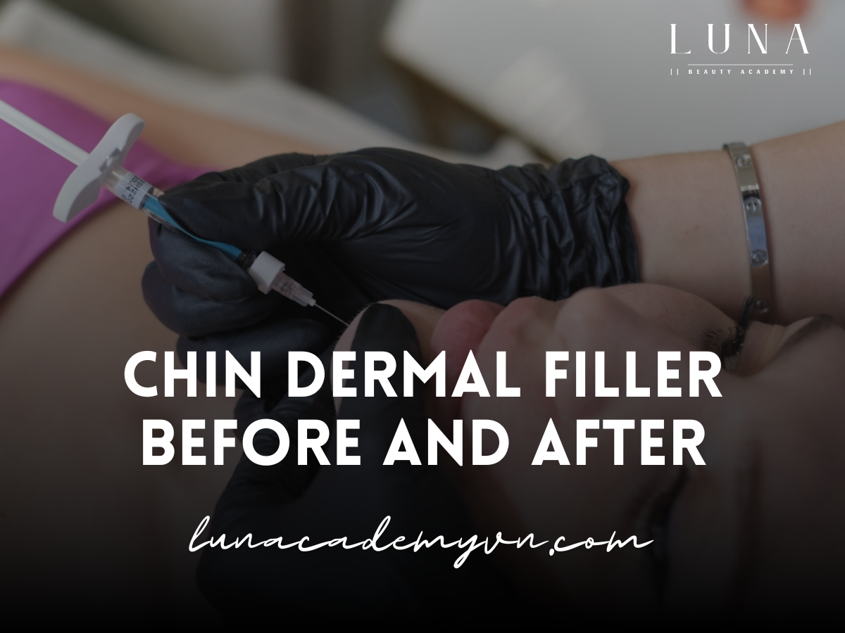 Chin Dermal Filler Before and After: Results Revealed