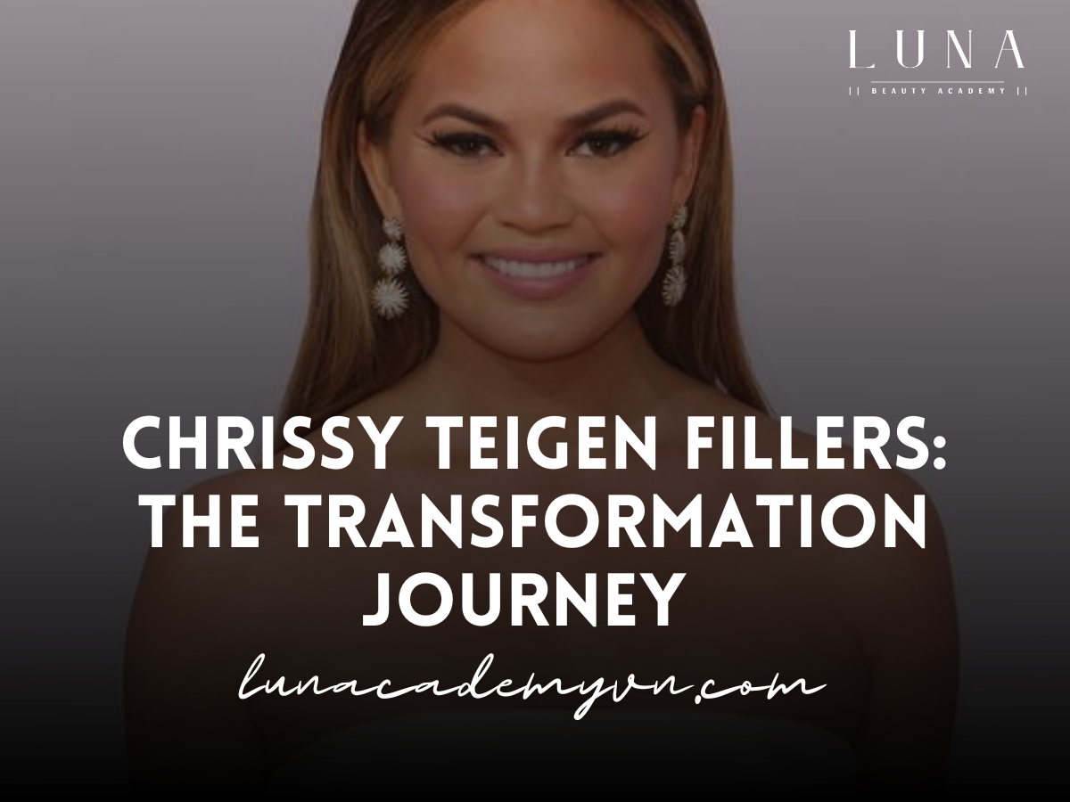 chrissy teigen fillers