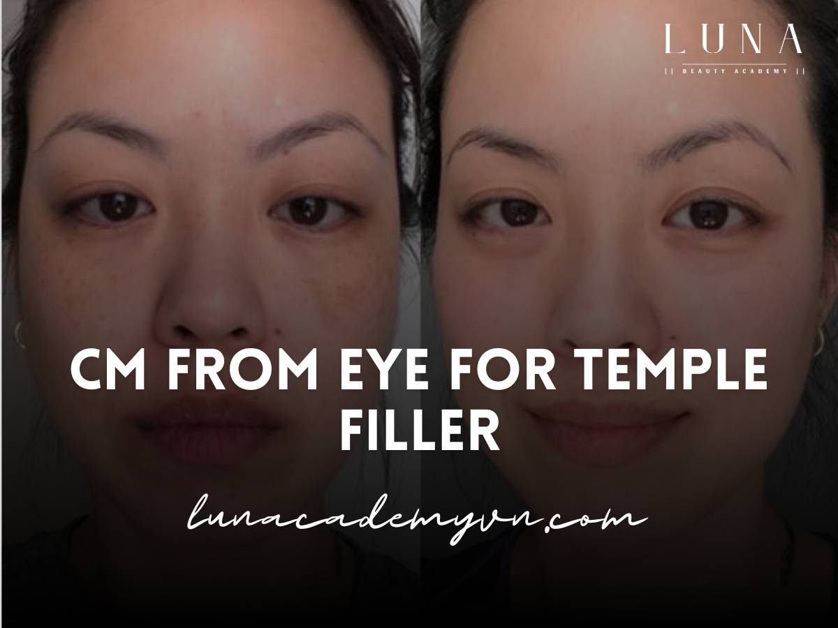 CM From Eye for Temple Filler