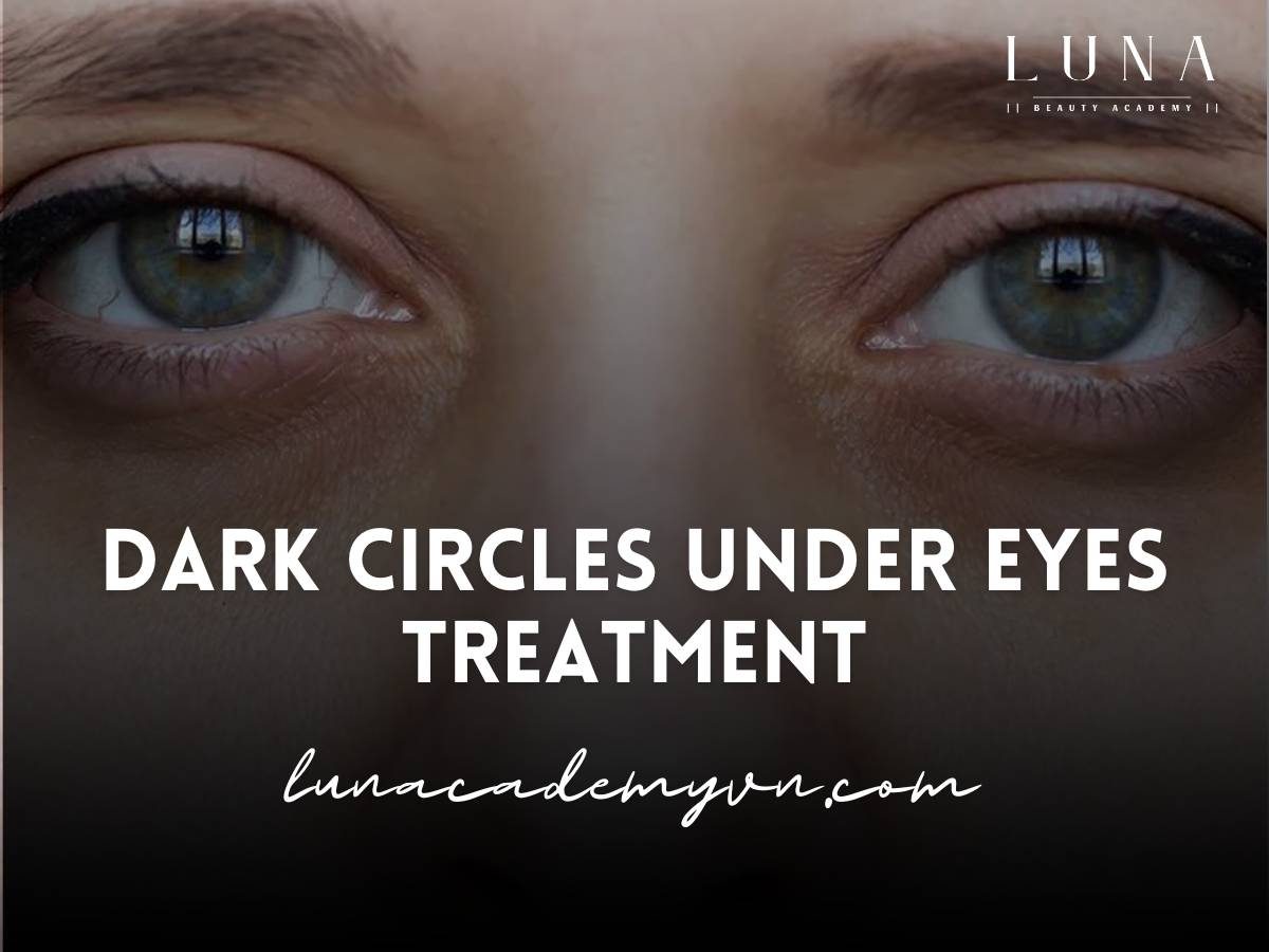 Dark Circles Under Eyes Treatment