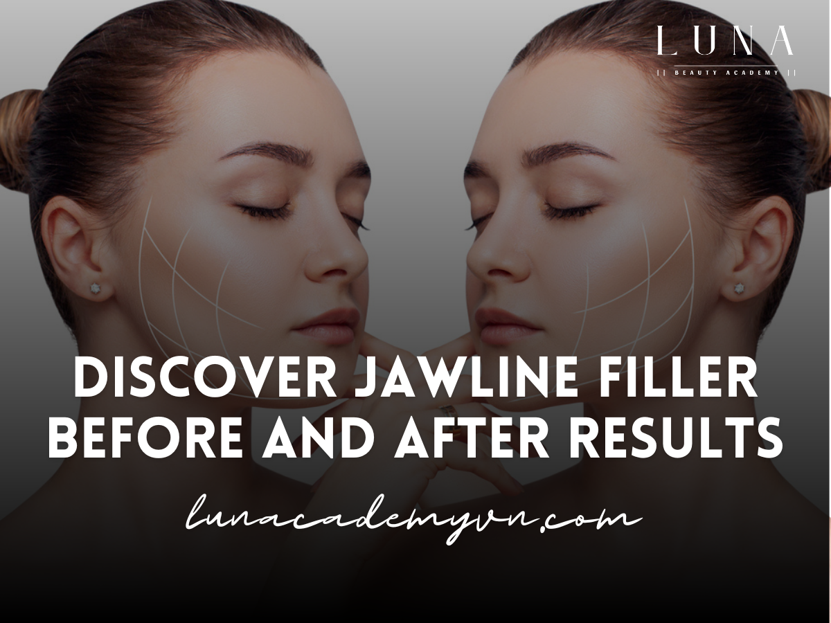 Jawline Filler Before and After