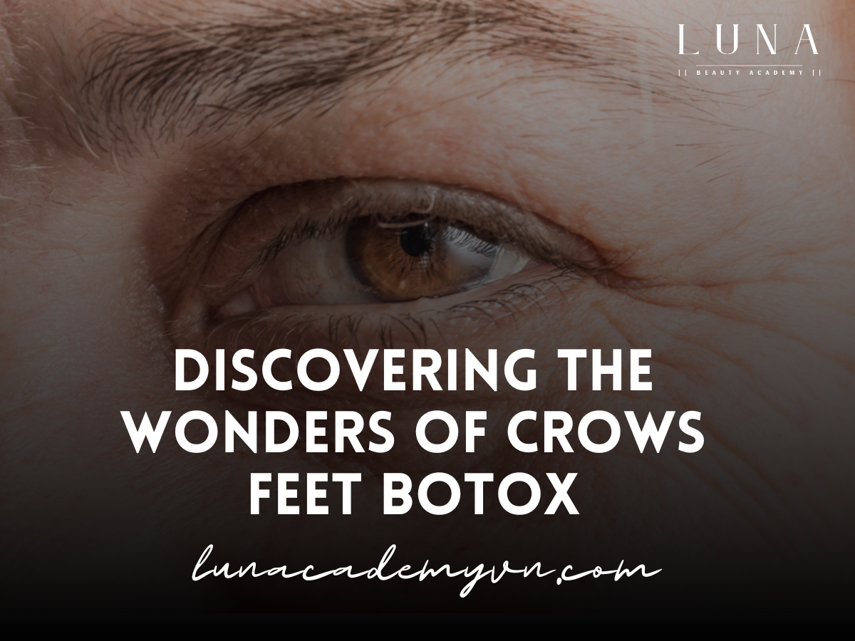 Discovering the Wonders of Crows Feet Botox