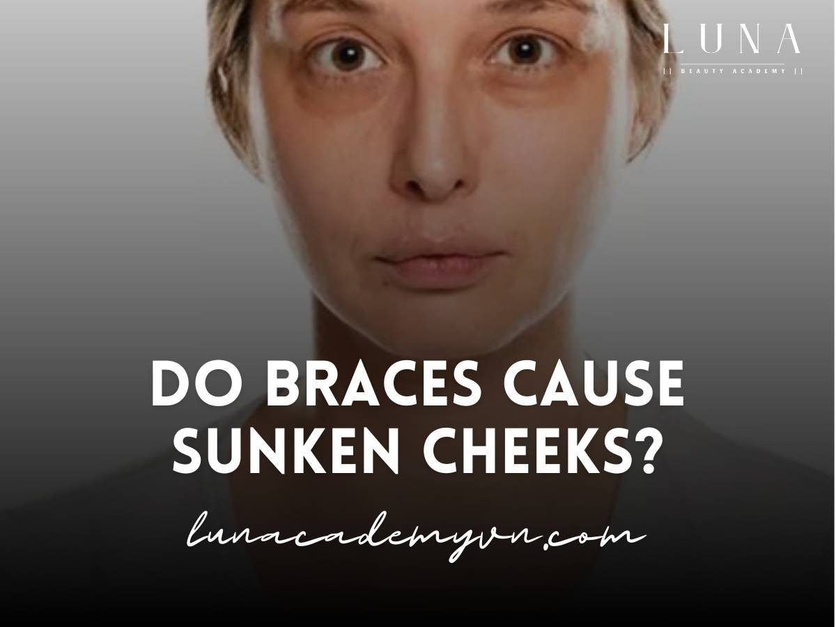 do braces cause sunken cheeks