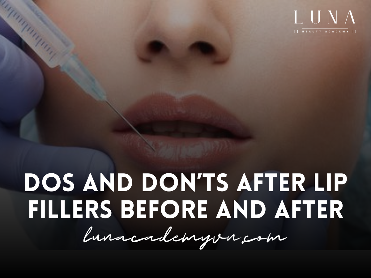 Dos and Don’ts After Lip Fillers Before and After