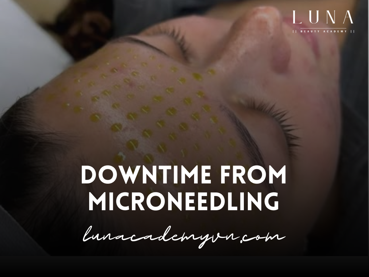 Downtime from Microneedling