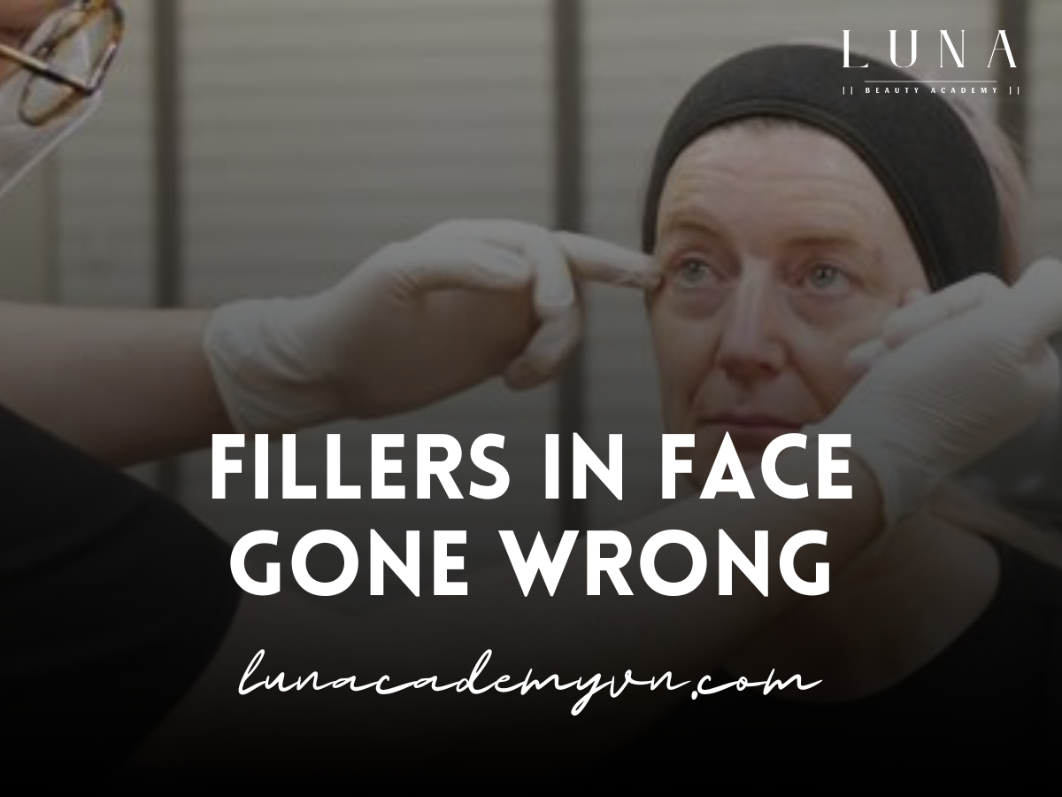 Fillers in Face Gone Wrong: What Happens When Cosmetic Procedures Fail?