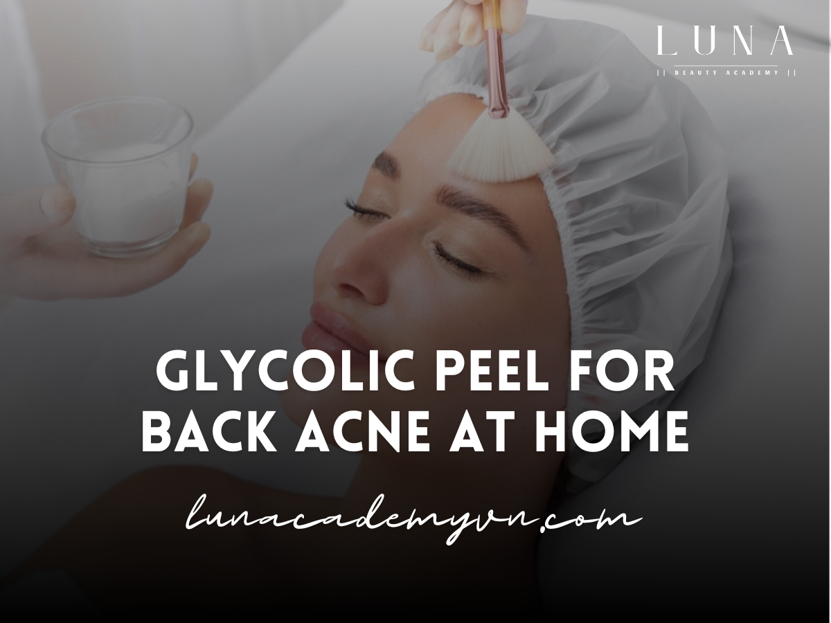 Glycolic peel for back acne at home