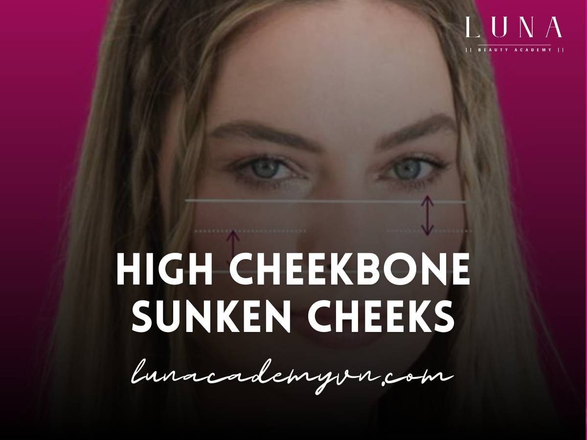 High cheekbone sunken cheeks