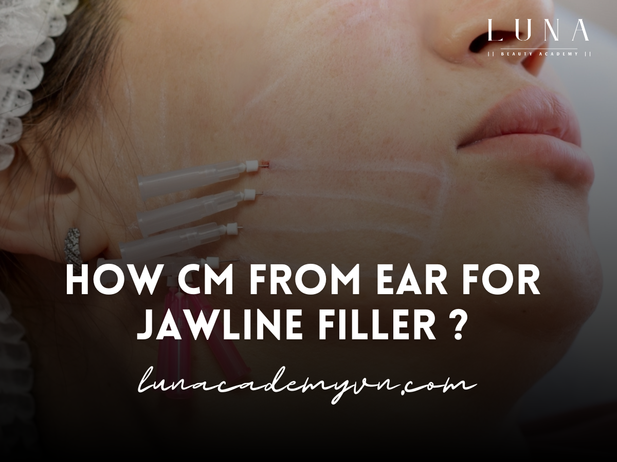 How cm from ear for jawline filler ?