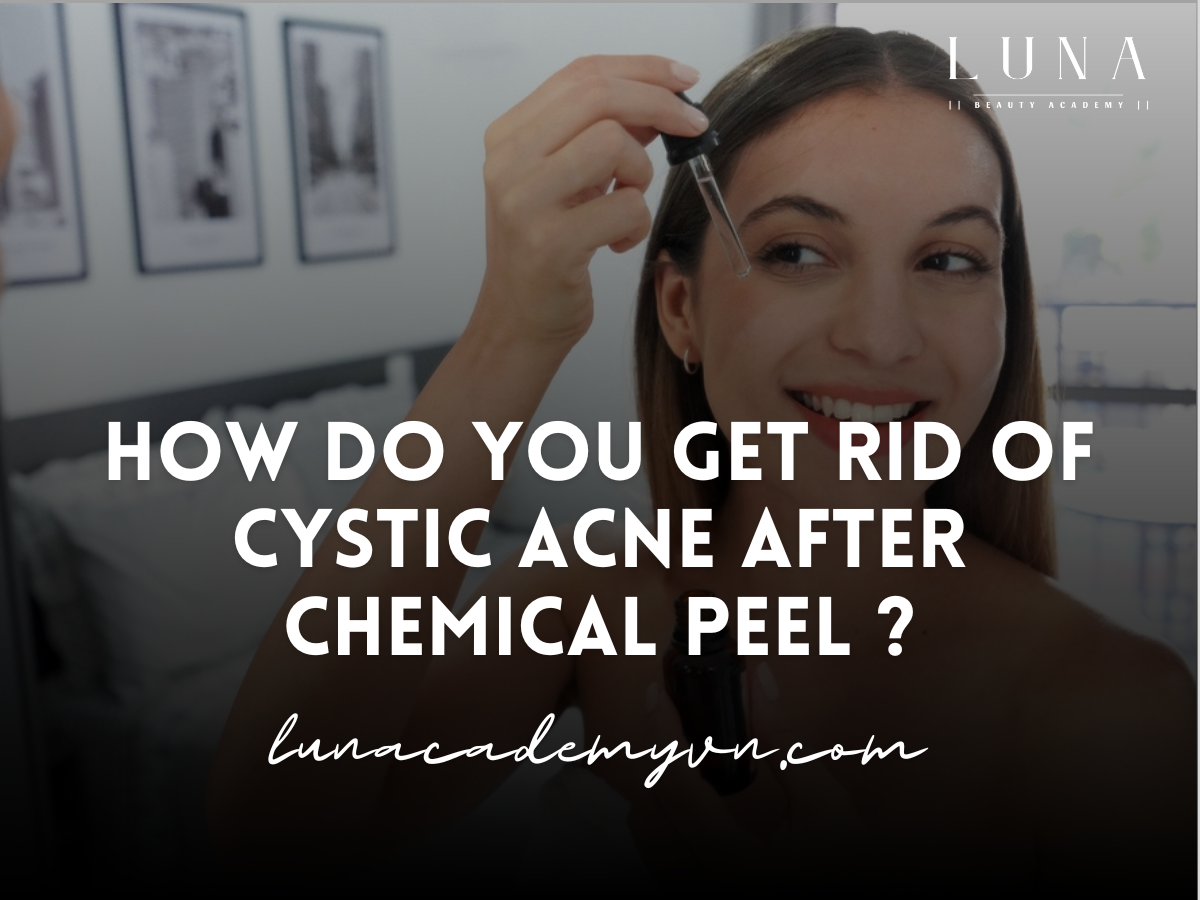 How do you get rid of cystic acne after chemical peel ?