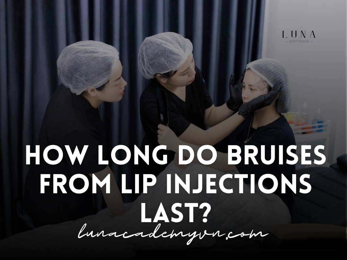 how long do bruises from lip injections last