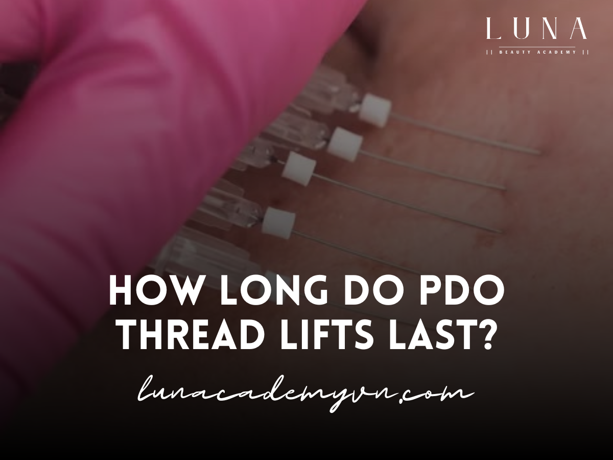 How Long Do PDO Thread Lifts Last?