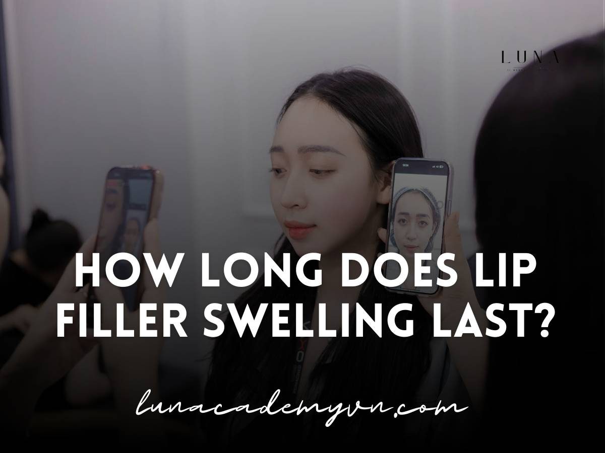 how long does lip filler swelling last