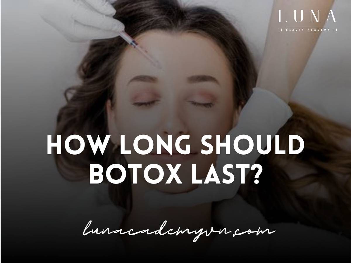 how long should botox last