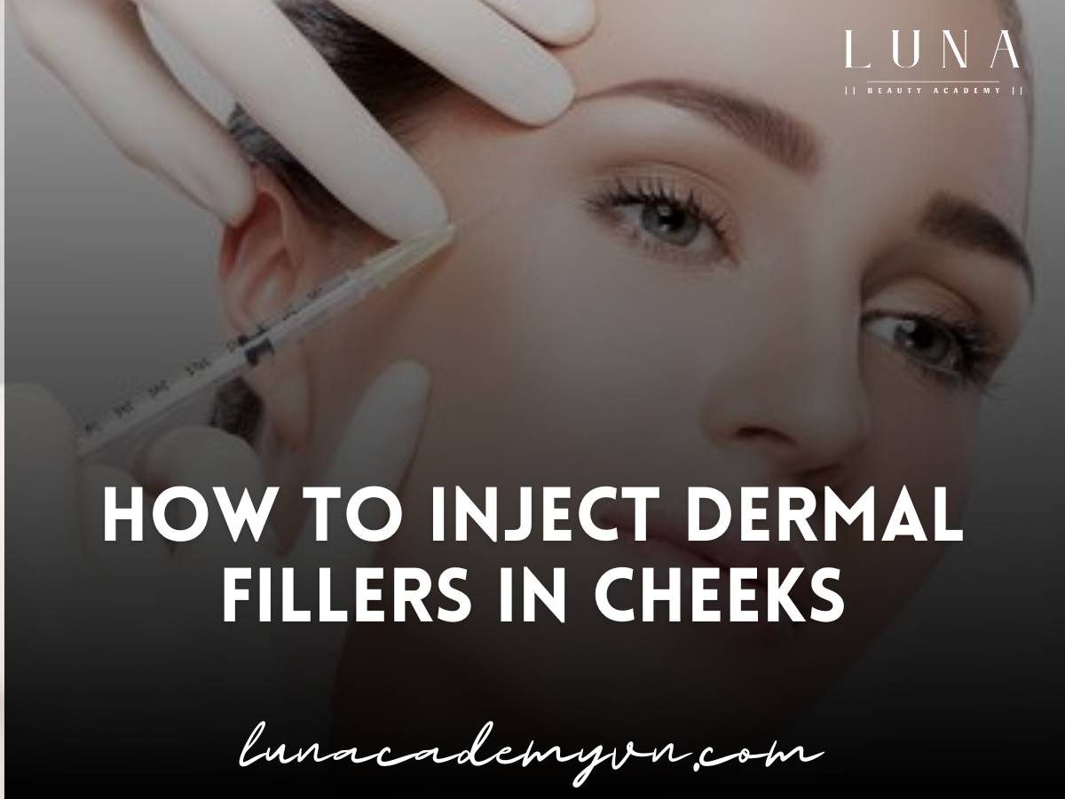 how to inject dermal fillers in cheeks