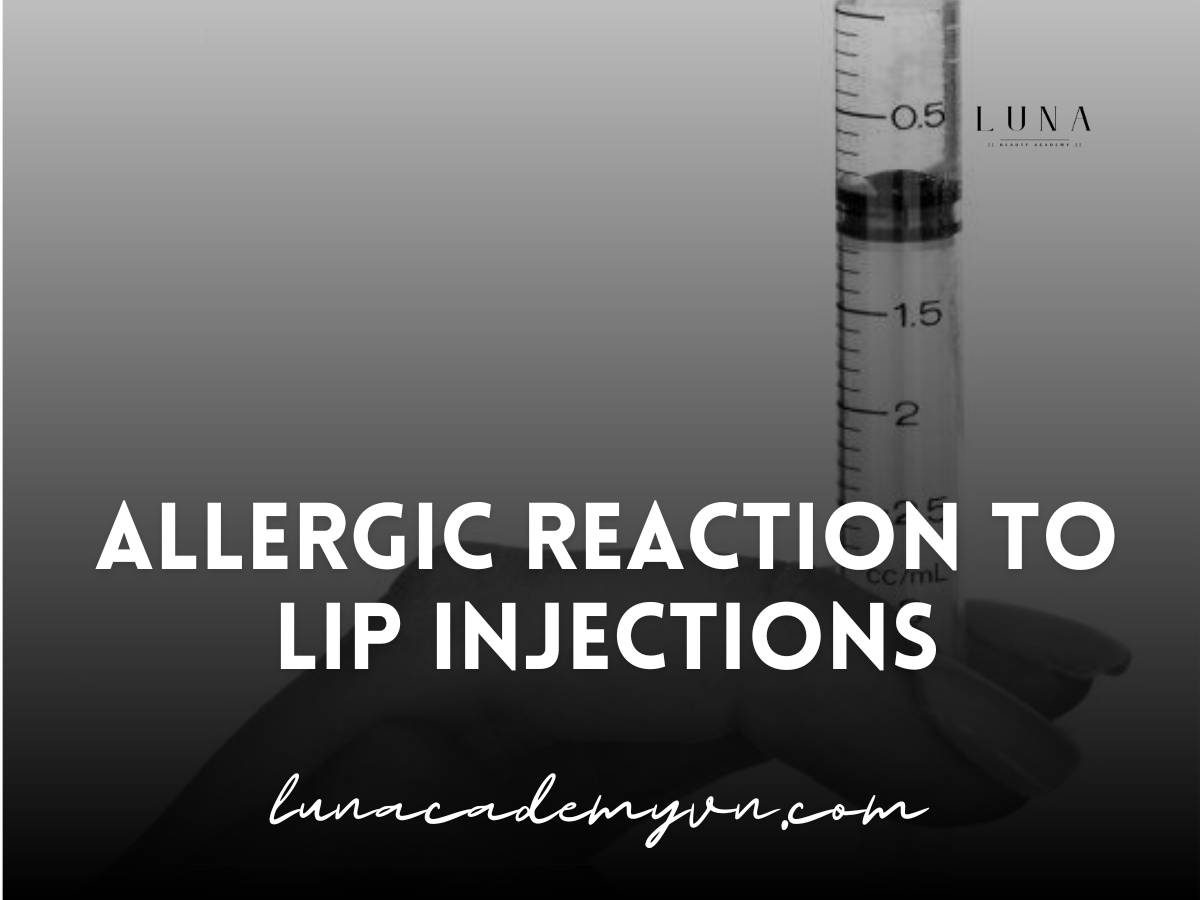 allergic reaction to lip injections