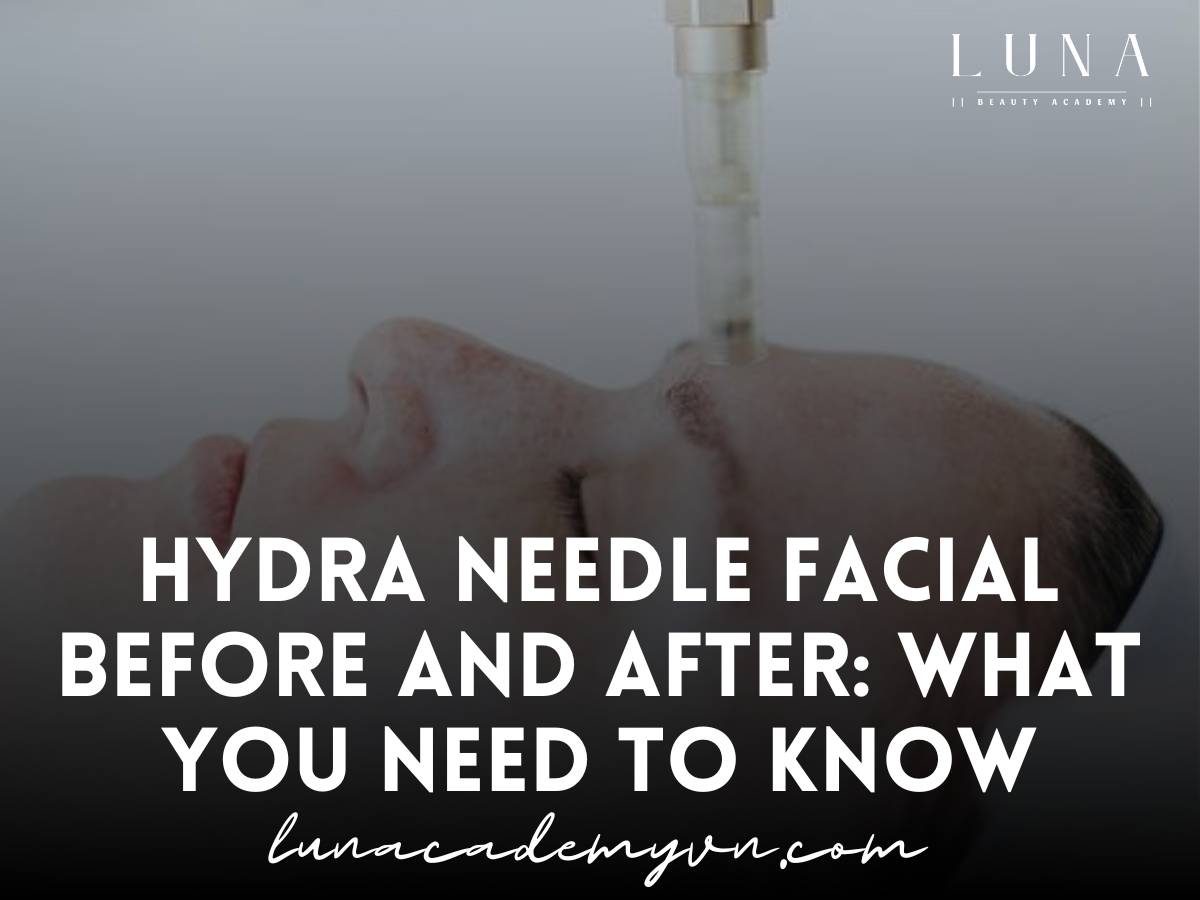 hydra needle facial before and after