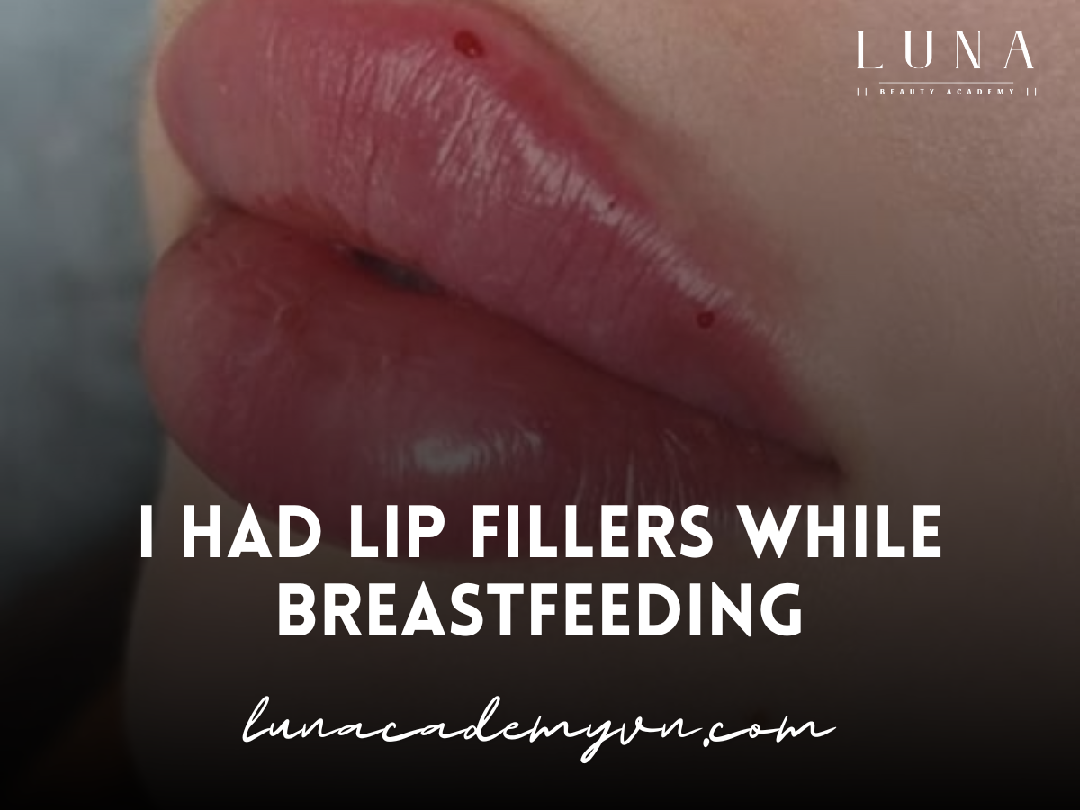 I Had Lip Fillers While Breastfeeding