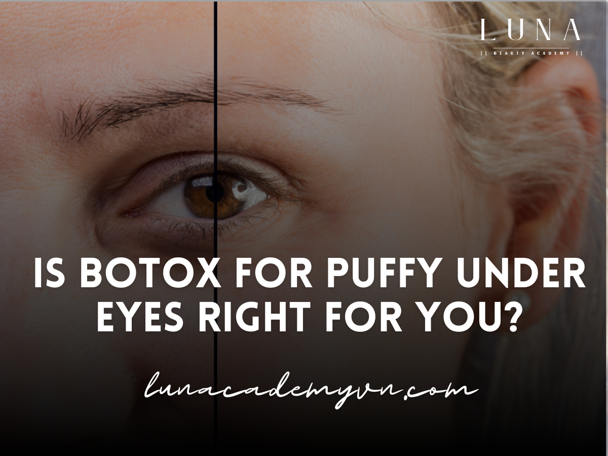 Is Botox for Puffy Under Eyes Right for You?