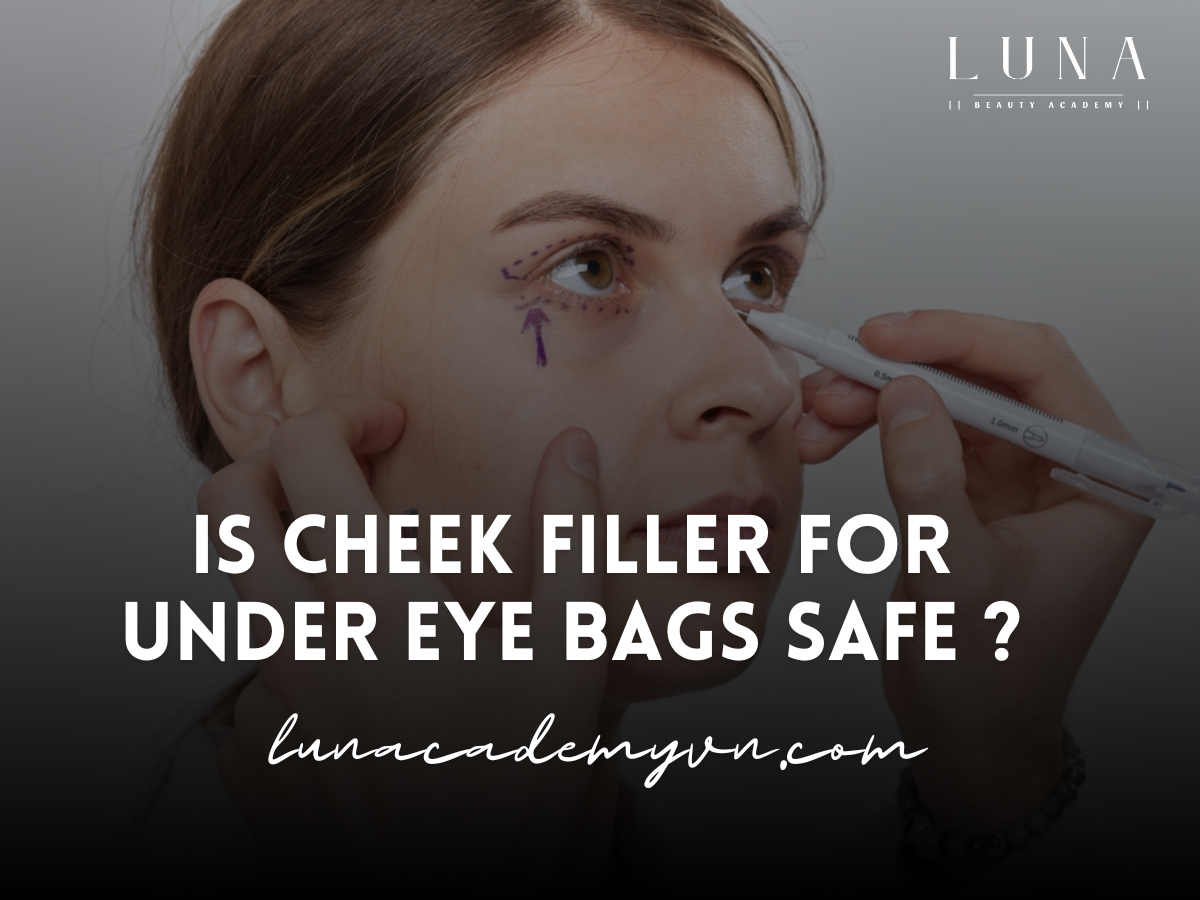 Is Cheek Filler for Under Eye Bags Safe ?