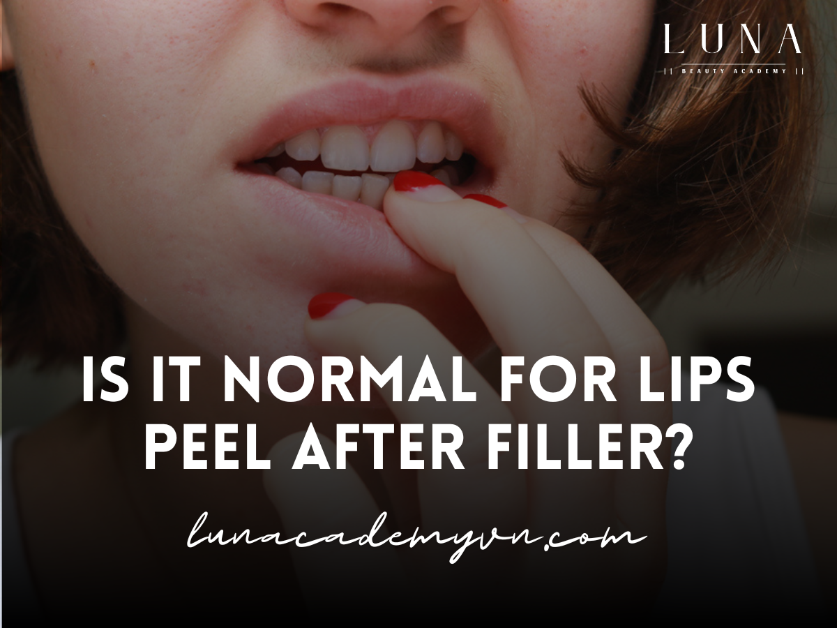 Is It Normal for Lips Peel After Filler?