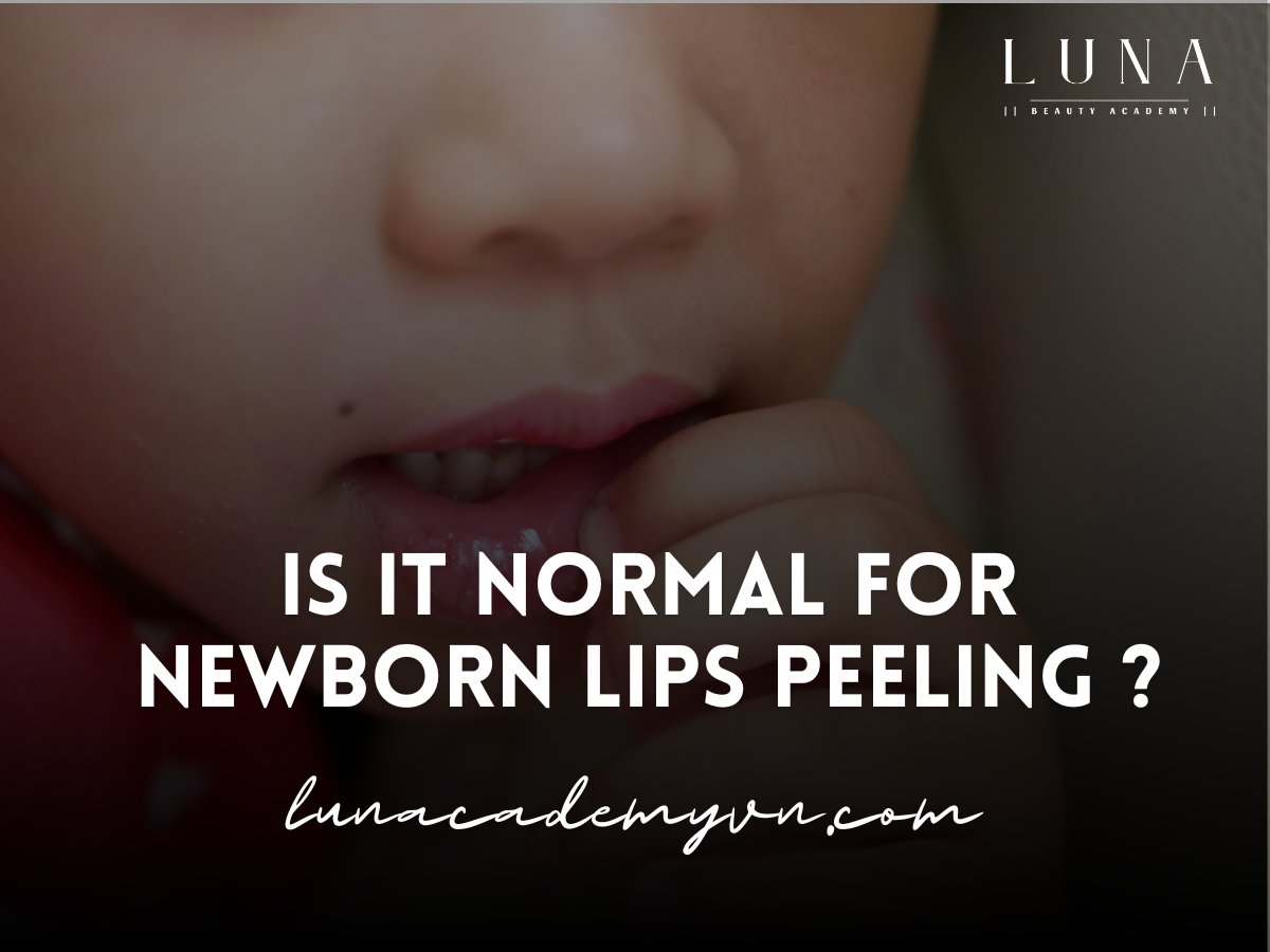 Is it normal for newborn lips peeling ?