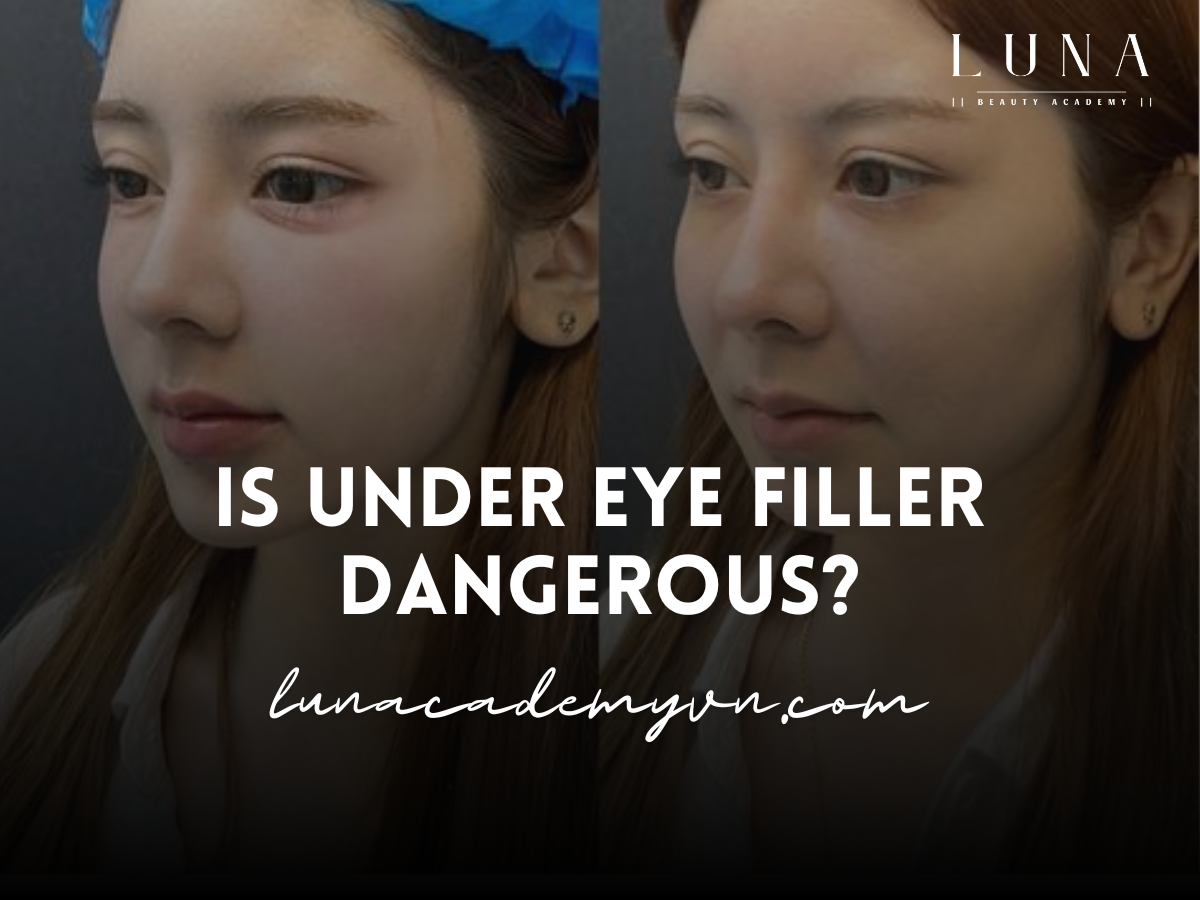 is under eye filler dangerous