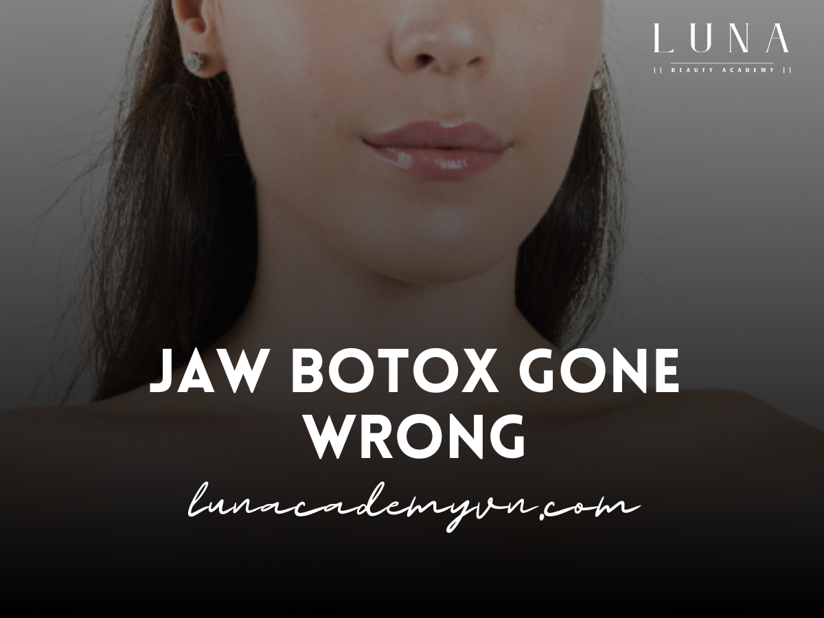 Jaw Botox Gone Wrong: What You Need to Know