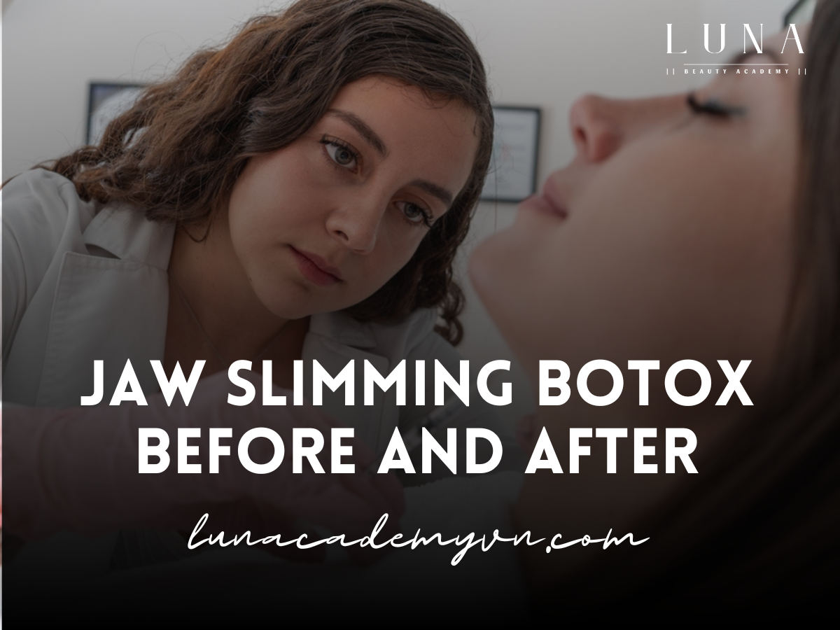 Jaw Slimming Botox Before and After