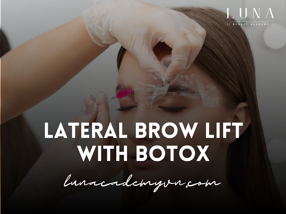 Lateral Brow Lift with Botox