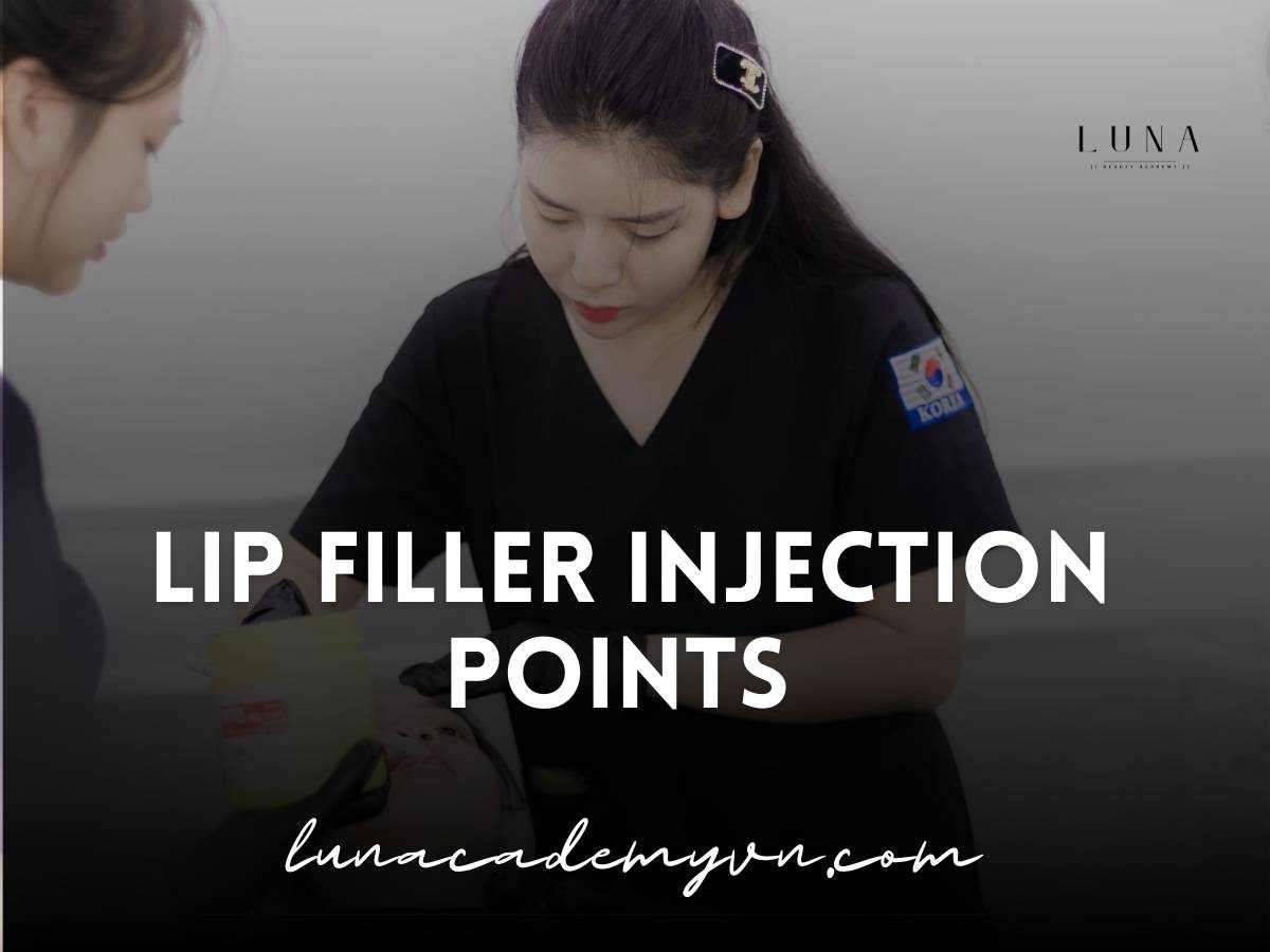 lip filler injection points