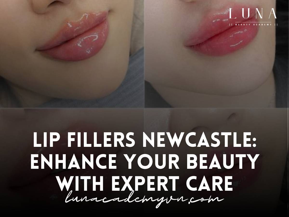 lip fillers newcastle